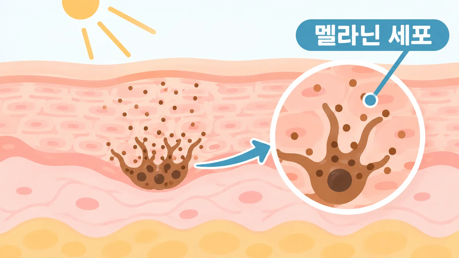 뷰티 마크는 점과 같은 것일까?